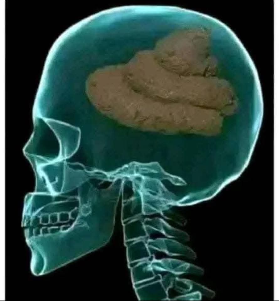 S-Head.jpg